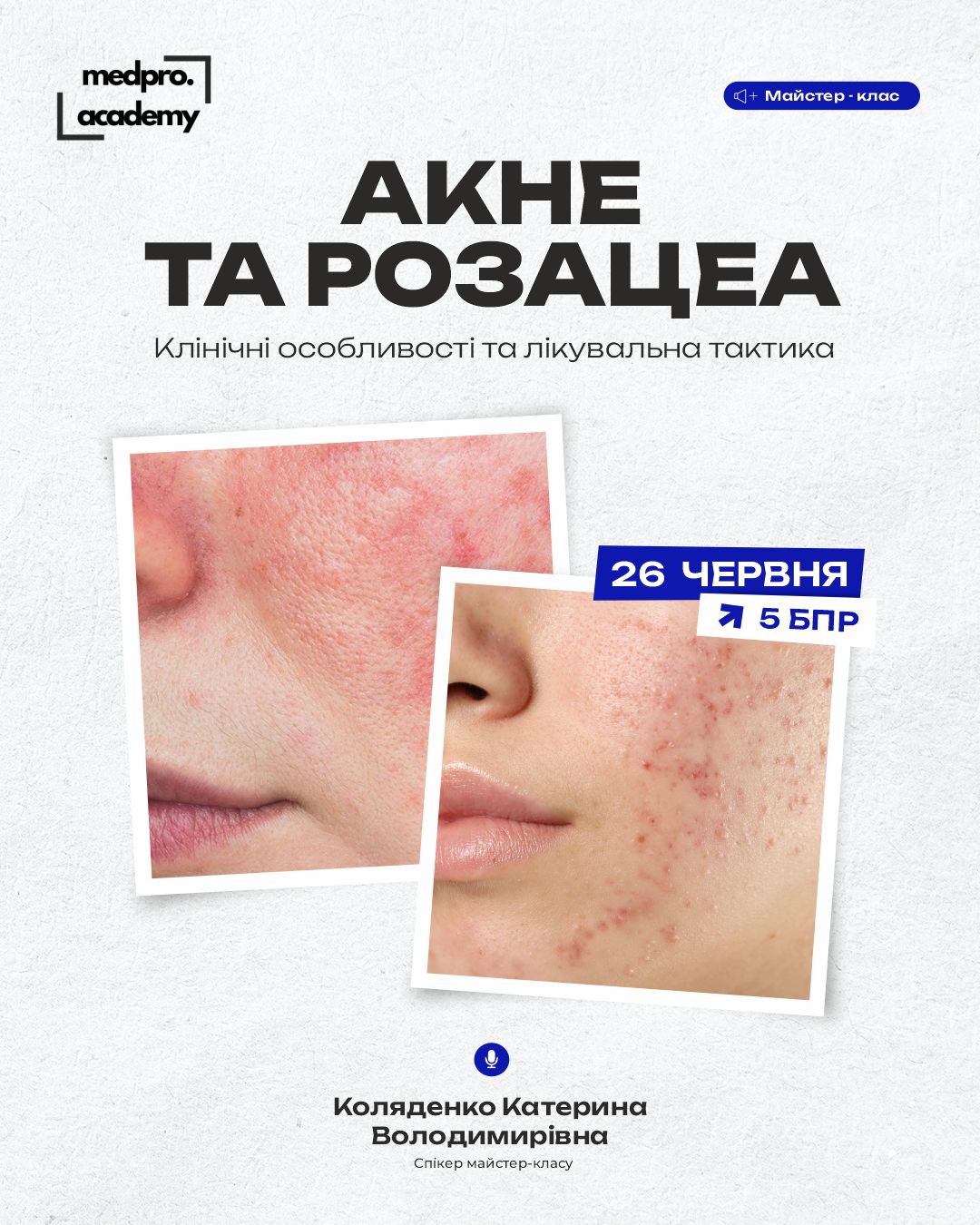 3Акне та розацеа клінічні особливості та лікувальна тактика